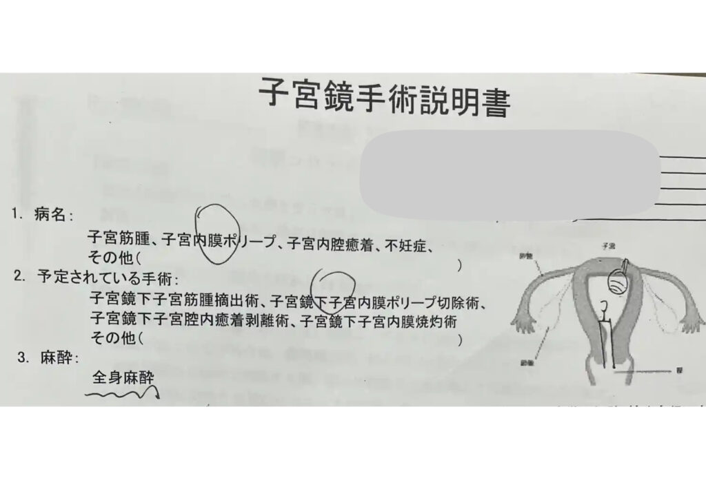 子宮鏡下子宮内膜ポリープ切除術と全身麻酔が記載された手術説明書の一部