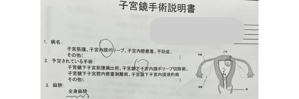 子宮鏡下子宮内膜ポリープ切除術と全身麻酔が記載された手術説明書の一部
